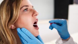 Cheek Swab for Pharmacogenetic Testing